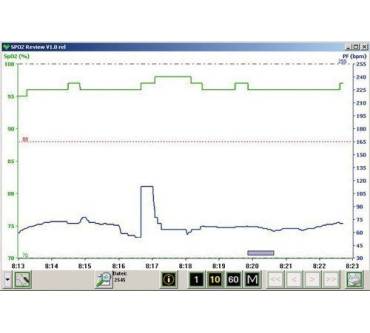 Produktbild Pulox CMS 50E